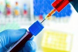 תסמונת קרי דו שה