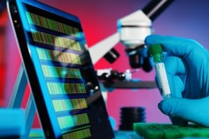 מהי תסמונת קורנליה דה לאנגה?